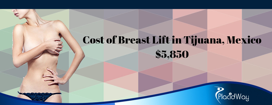 Cost of Breast Lift in Tijuana, Mexico